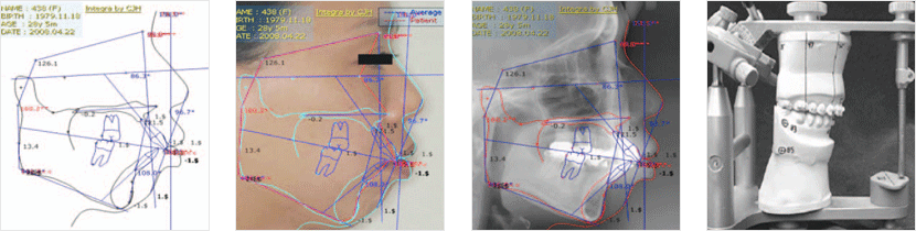���μ� (Esthetic line)