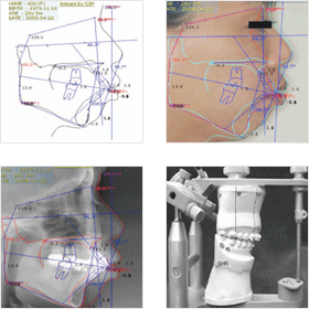 ���μ� (Esthetic line) �� ���Ͽ�