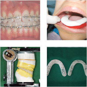 �ǰ� ������ġ ���� (���� ��, ���� �� ���)